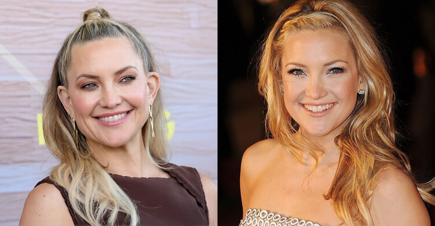 Kate Hudson teeth 1